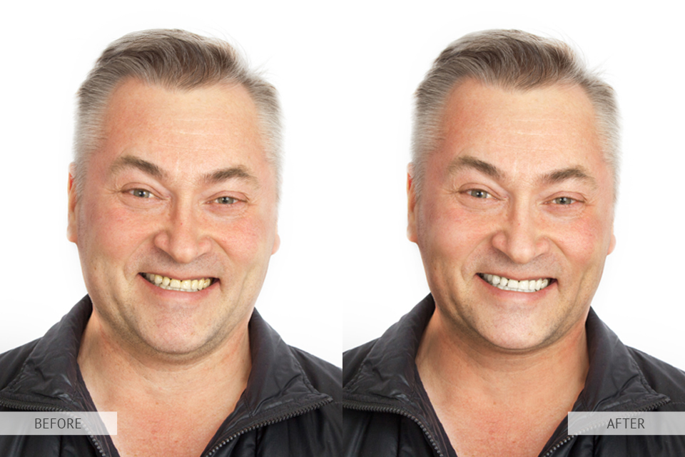 remove double chin photoshop final result